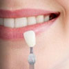 Porcelain Veneers